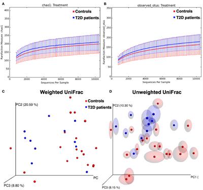 Detection of Increased Plasma Interleukin-6 Levels and Prevalence of Prevotella copri and Bacteroides vulgatus in the Feces of Type 2 Diabetes Patients